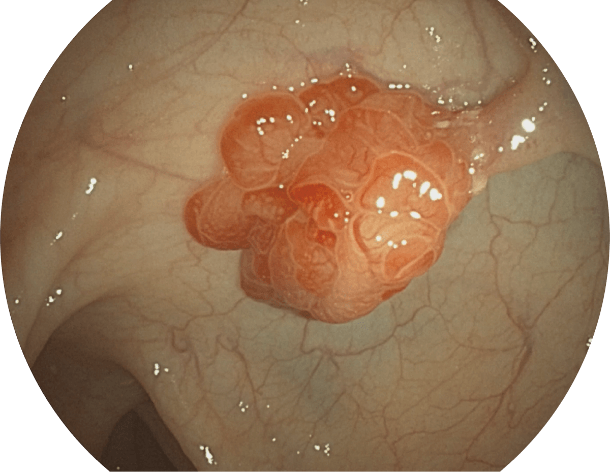 Endoscopio electrónico Sonoscape X-2600 — imagen 1