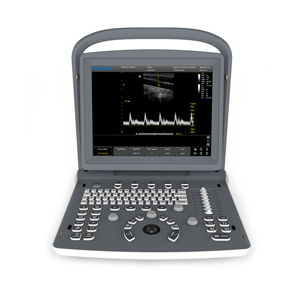 Portable B/W Ultrasound CHISON ECO2 — image 1