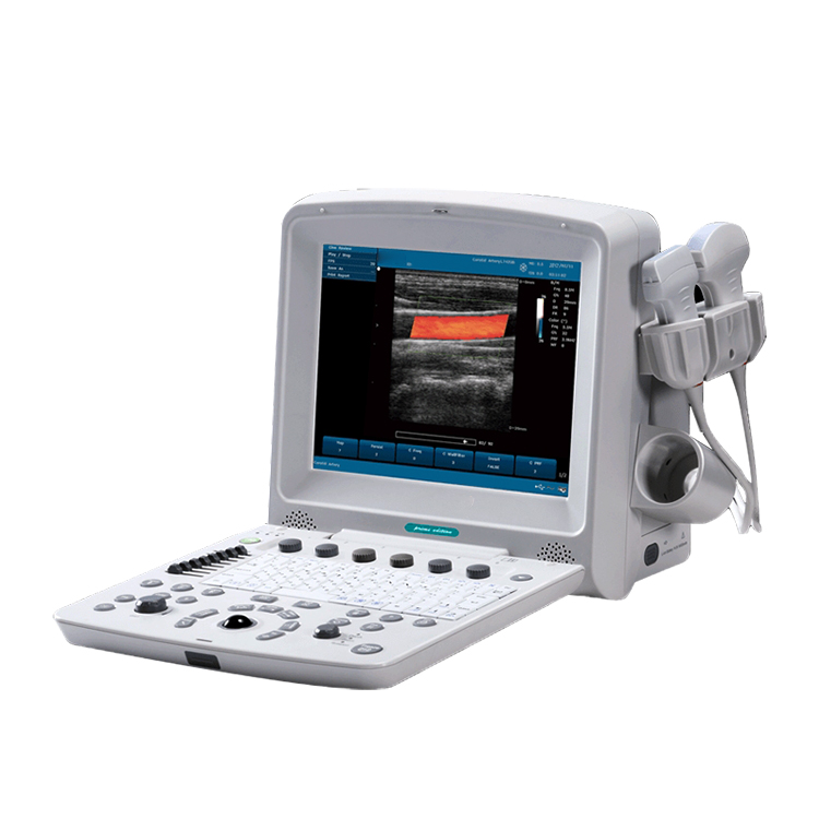 Ecógrafo Doppler color portátil EDAN U50 — imagen 1