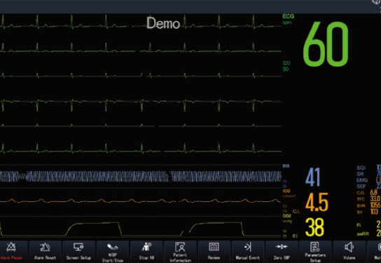 COMEN K Pro Series Patient Monitor — imagen 3
