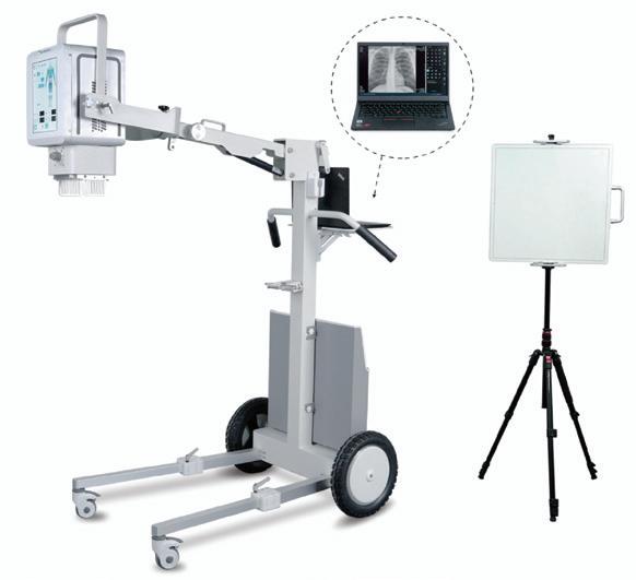 Unidad de rayos X portátil digital de 5,6 kW YSX056-PE (YSF056DR-A) — imagen 1