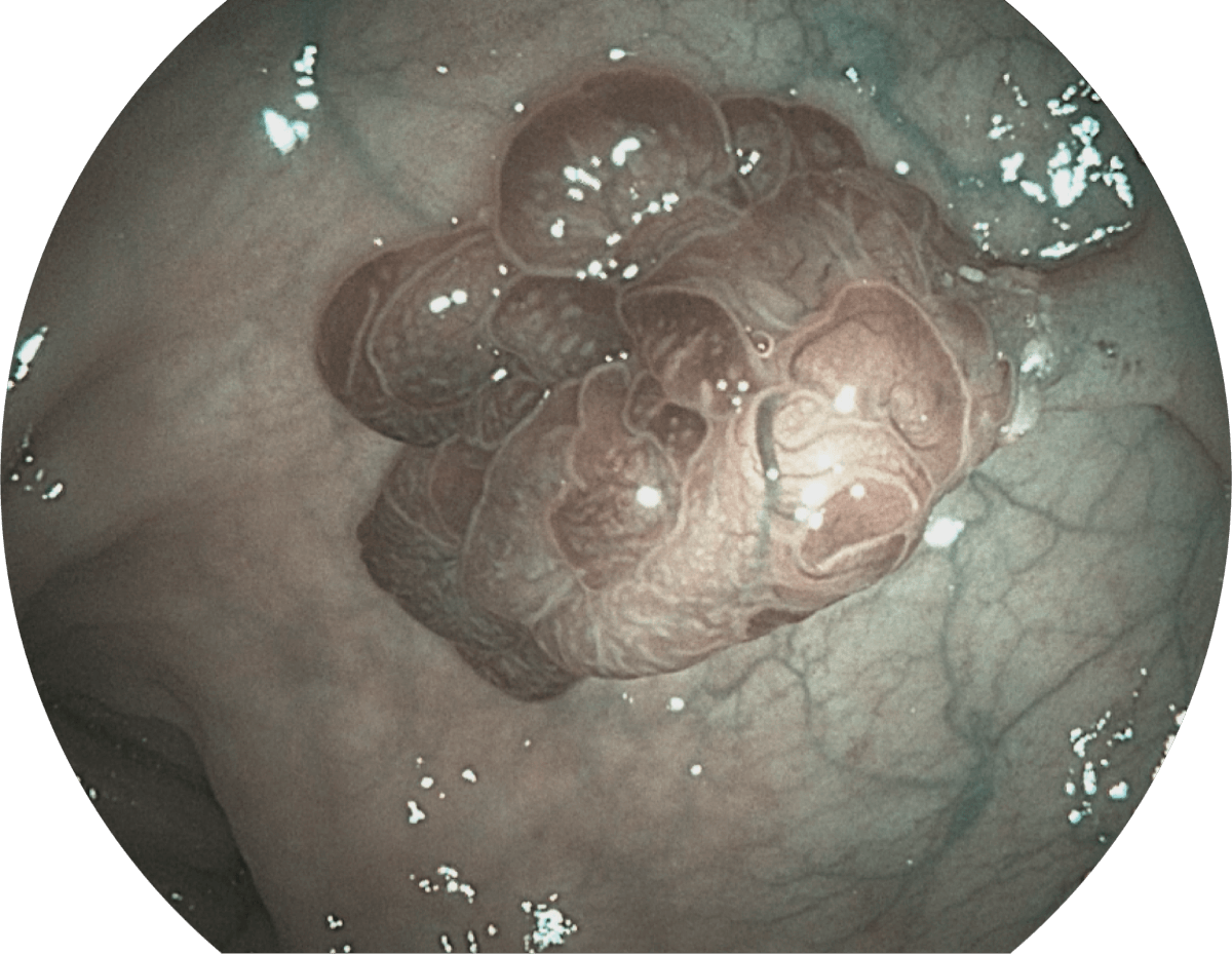 Endoscopio electrónico Sonoscape X-2600 — imagen 3