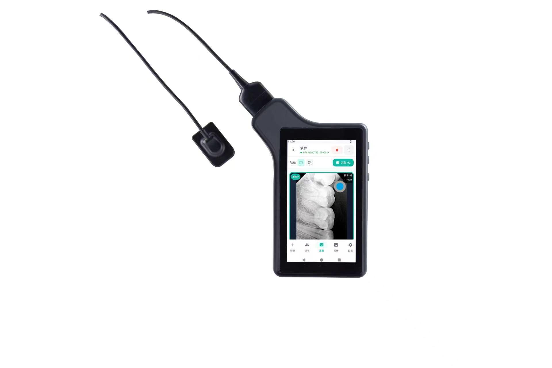 Sistema de imagen con sensor intraoral digital YSDEN-DR535 — imagen 1