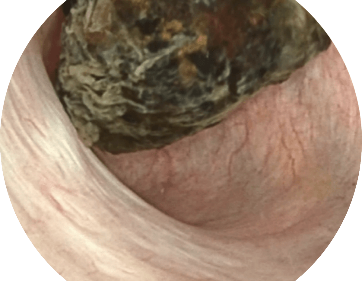 Endoscopio electrónico Sonoscape X-2600 — imagen 5